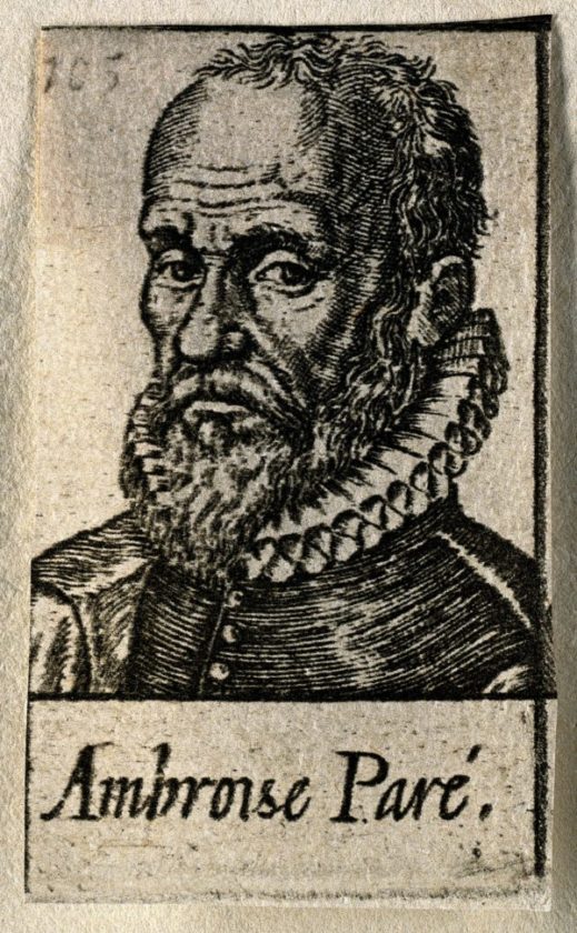 AMBROISE PARÉ L’ANCIEN BARBIER DEVENU CHIRURGIEN PRÉCURSEUR
